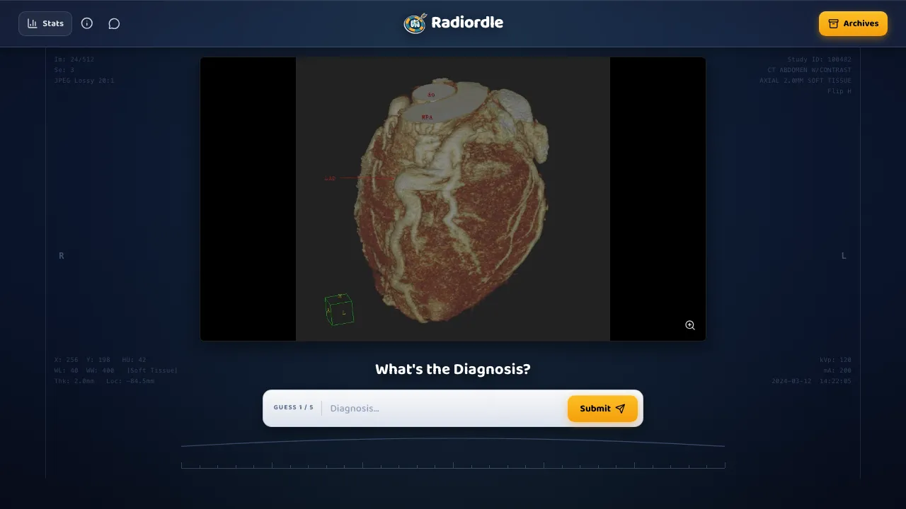 Radiordle cover